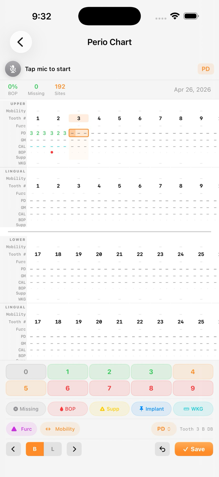 PerioMaxer periodontal chart screen